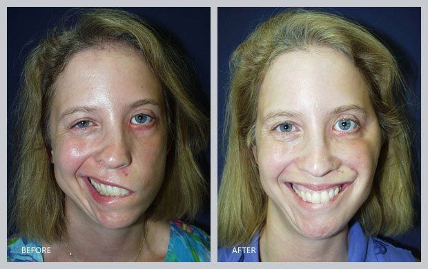 best of Surgeon plastic Facial reanimation