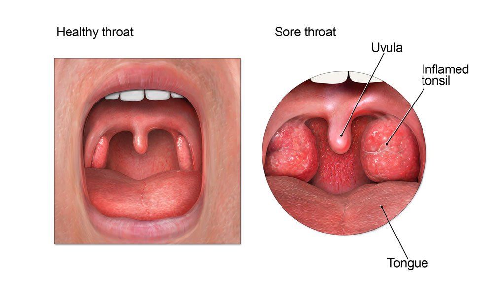 best of G Strip throat type