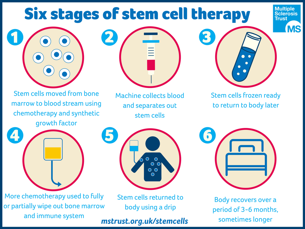 best of Sclerosis cells multiple cells stem Adult Stem