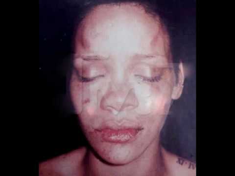 best of Injuries rihannas Pictures of facial