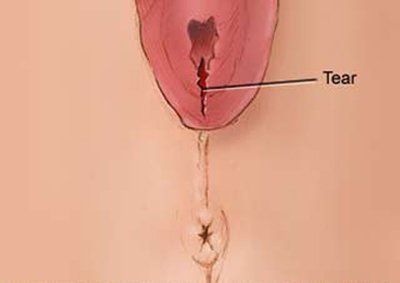 Male anal secretion
