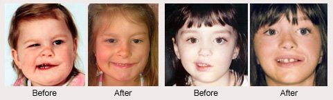 Cherry reccomend Facial reanimation plastic surgeon