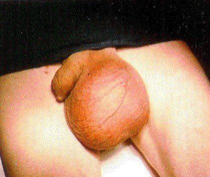 best of Penis young vagina eunuch Testicle