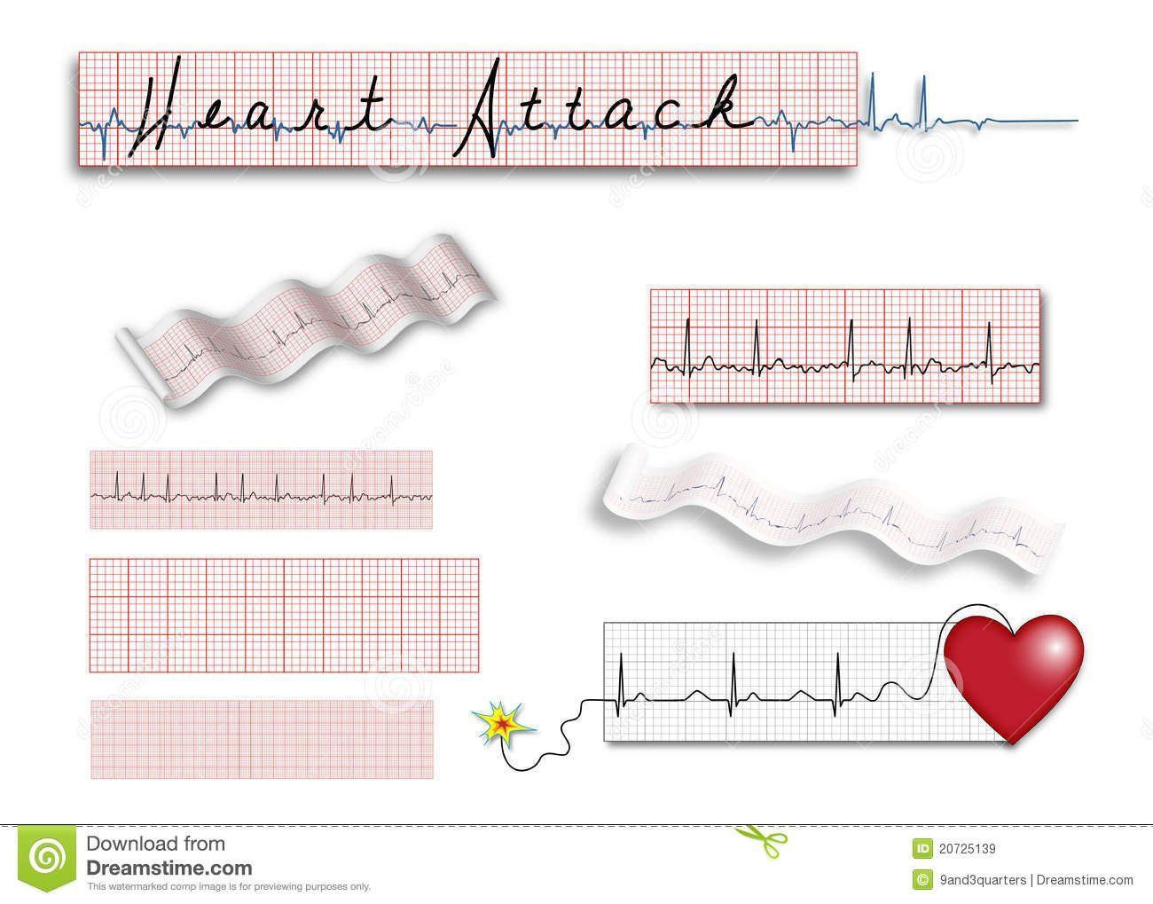Cardiac heart ekg strip