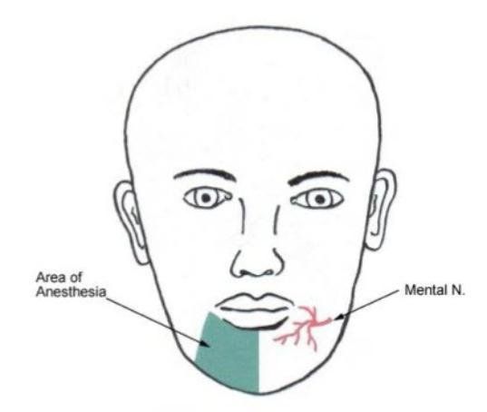 Facial numbness syndrome