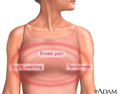 Gla breast pain