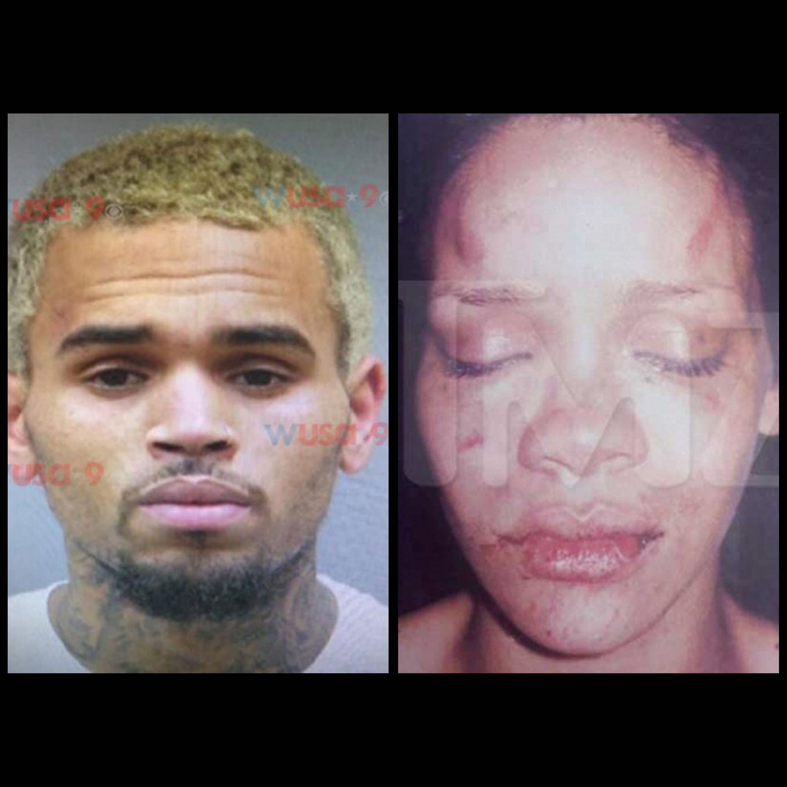 Pictures of rihannas facial injuries