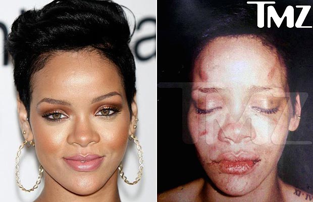 Pictures of rihannas facial injuries