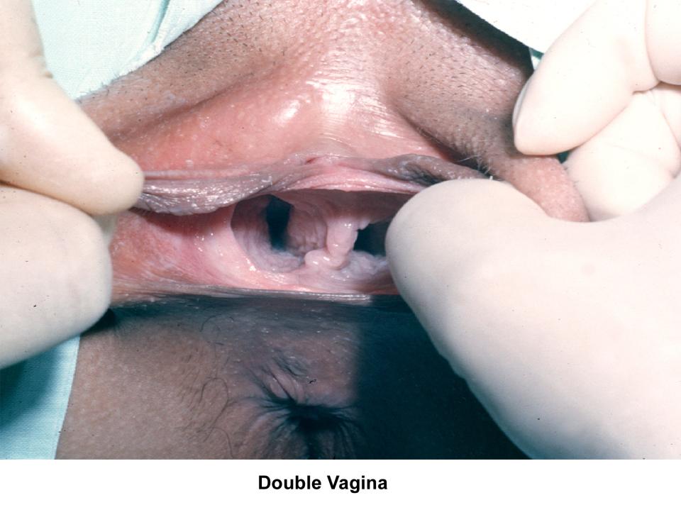 Pics of nude women with double vagina